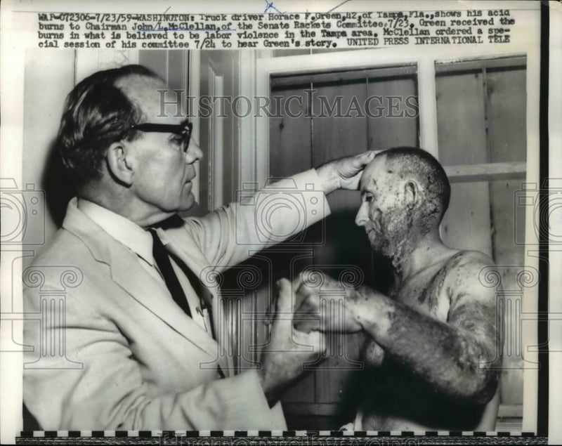 Load image into Gallery viewer, 1959 Press Photo Wash DC Horace Green &amp; acid burns with Sen JL McClellan
