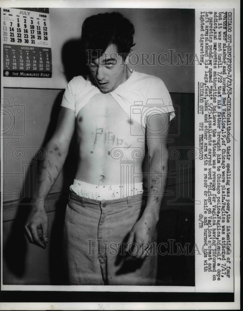 1958 Press Photo Chicago Ned Vaglica 19, was attacked and slashed and burned