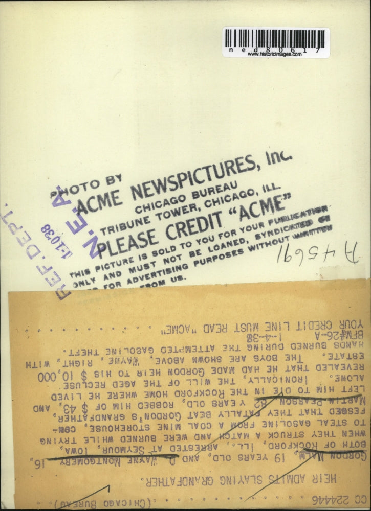 1938 Press Photo Gordon Malm with arms burned during a gasoline attempted theft