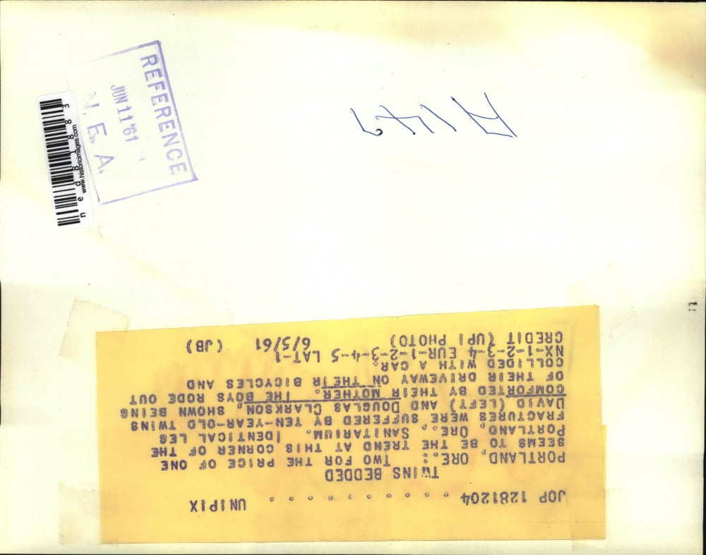 1961 Press Photo Twins David and Douglas Clarkson suffer Identical Leg Fractures