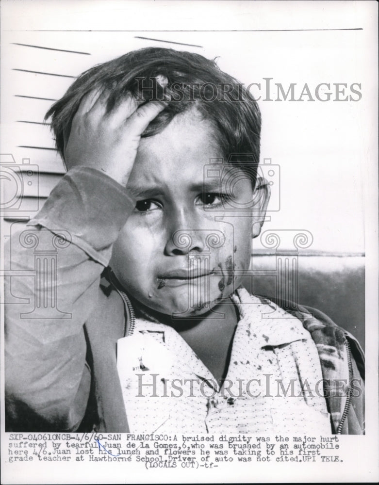 1960 Press Photo San Francisco Juan de la Gomez age 6 scatched by auto accident