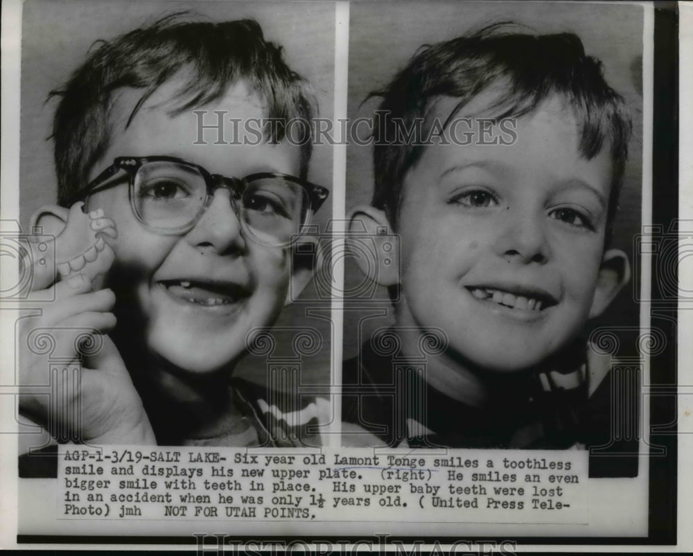 1955 Press Photo Lamont Tonge displays his new upper teeth plate