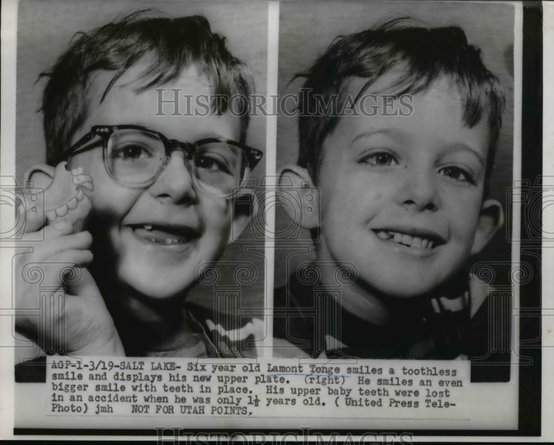 Load image into Gallery viewer, 1955 Press Photo Lamont Tonge displays his new upper teeth plate
