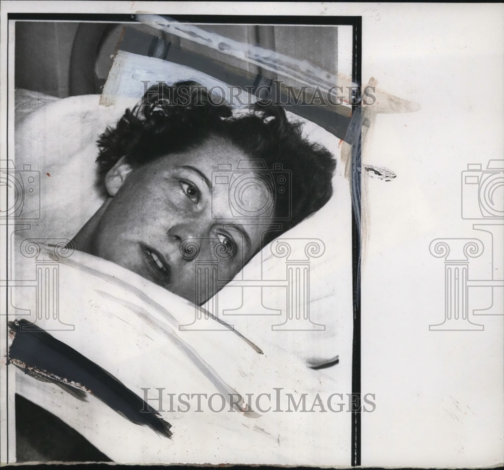 1957 Press Photo Margaret Wilkinson escaped from fire,5 children died