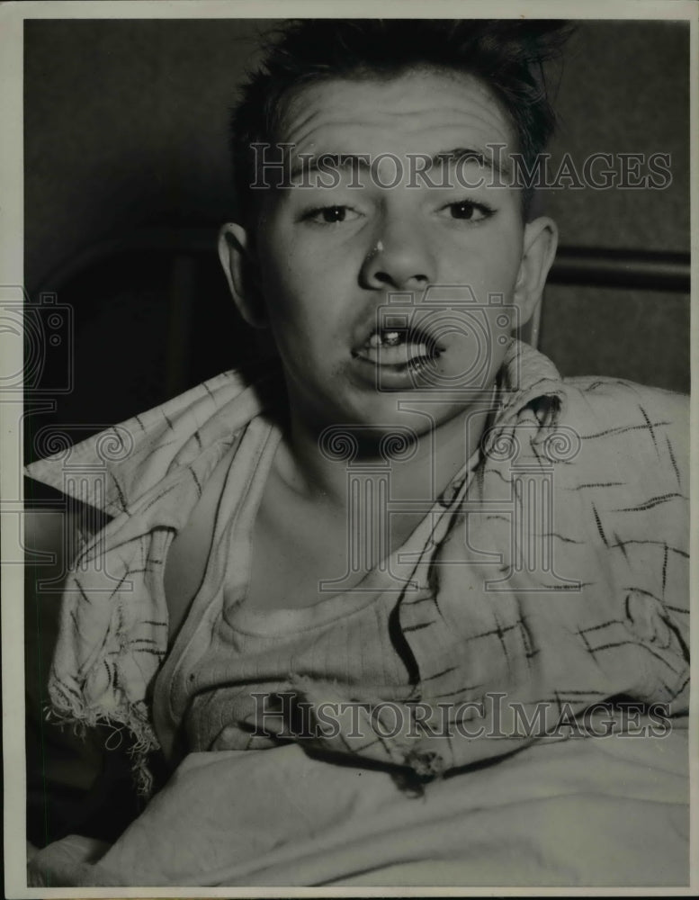 1941 Press Photo of Samuel Long Jr. 15, after being beaten by policeman John
