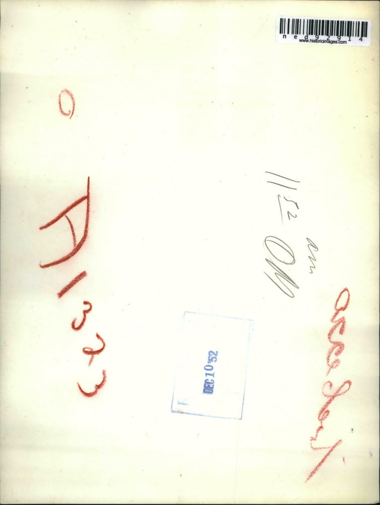 1950 Press Photo of a fireman cutting a washer off of the finger of Danny Mele.