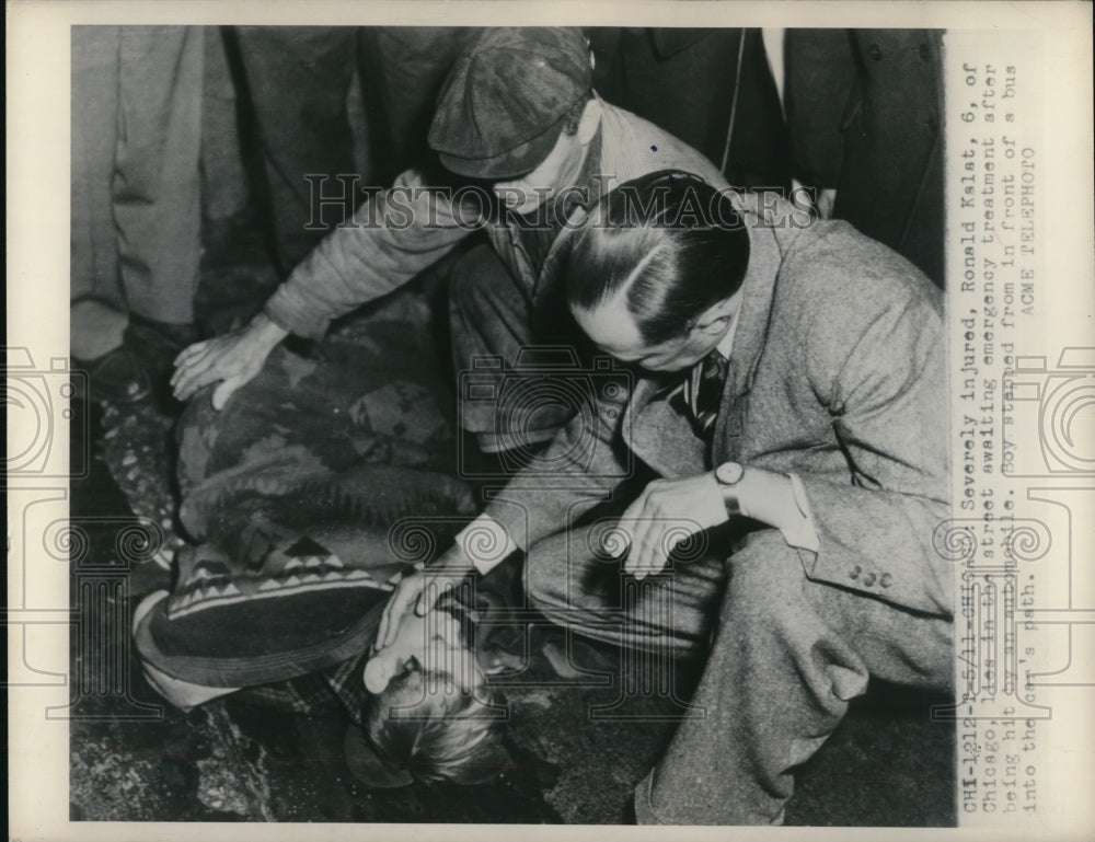 1948 Press Photo Chicago Ronald Kals age 6 t injured struck by a car