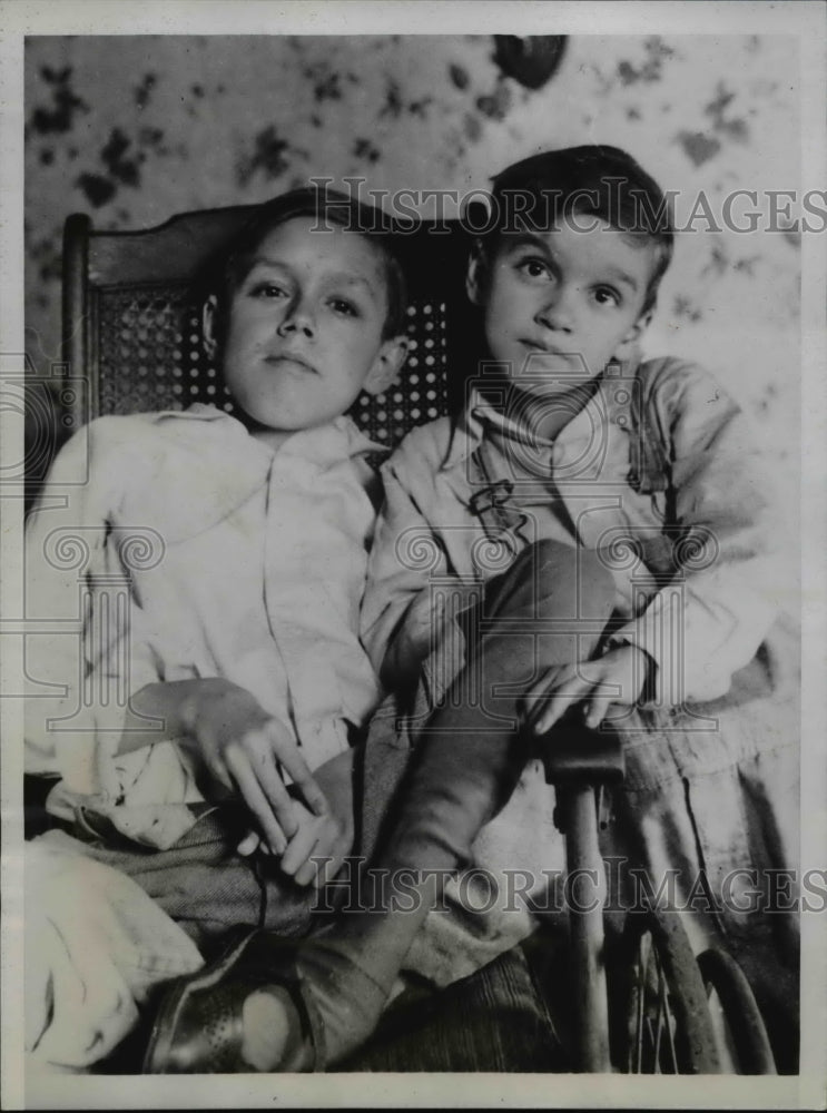 1934 Press Photo Charles & William Wagner Muncie Ind turning to stone by disease