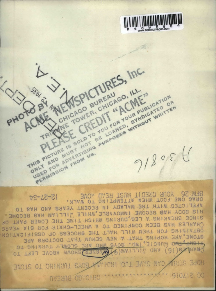 1934 Press Photo Charles & William Wagner Muncie Ind turning to stone by disease