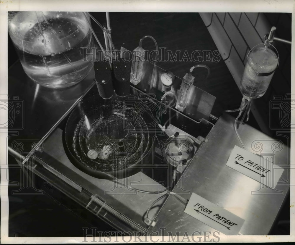 1959 Press Photo Top View of the New Westinghouse Plastic Kidney - nee00961