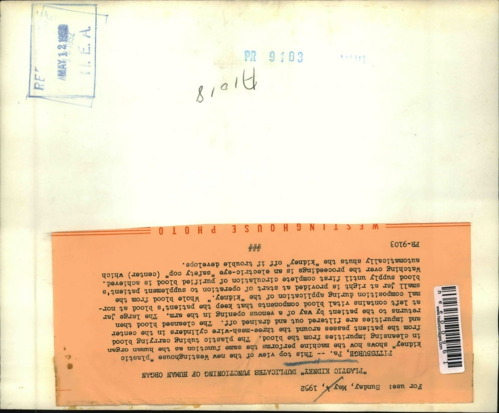 1959 Press Photo Top View of the New Westinghouse Plastic Kidney - nee00961