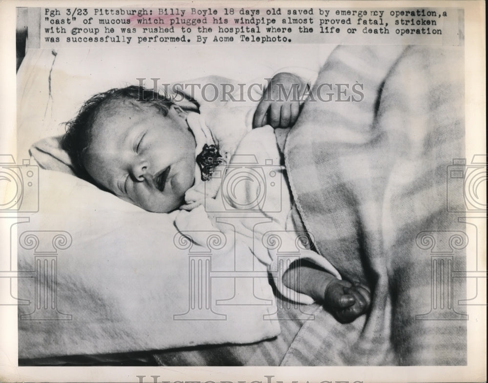 1949 Press Photo Pittsburgh Pa baby Billy Boyle saved from windpipe blockage- Historic Images