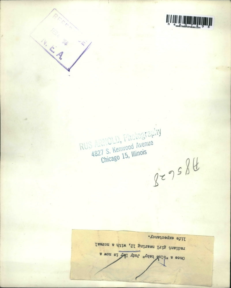 1954 Press Photo Judy Ley,12, Once a blue baby now with normal life expectancy