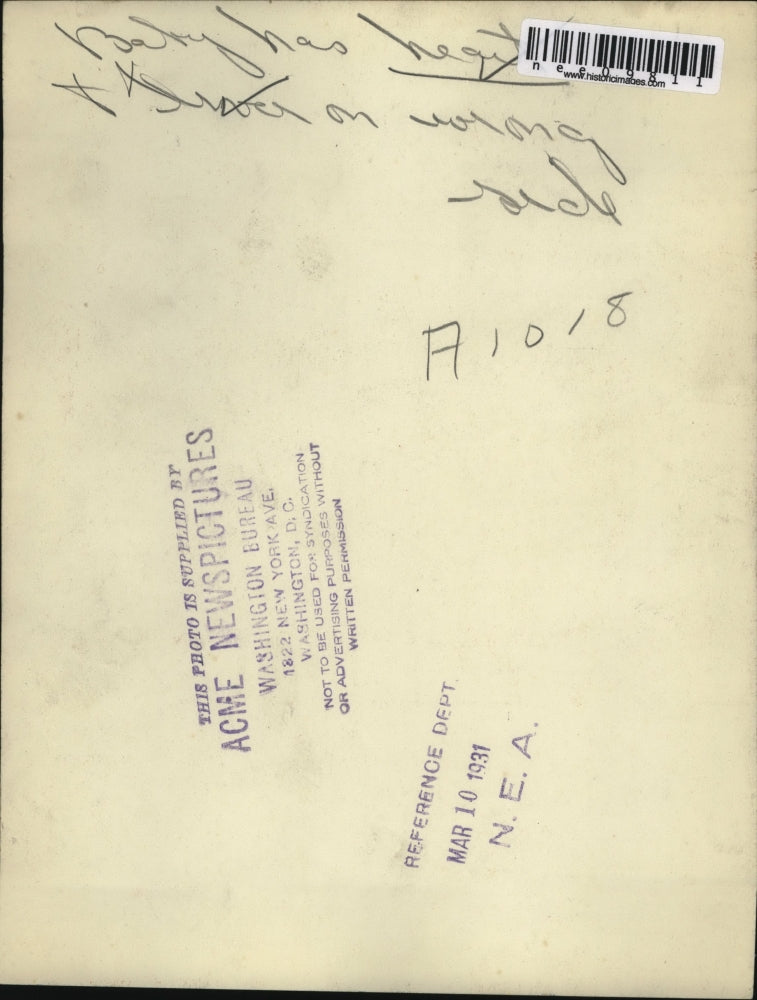 1931 Press Photo A baby who has heart on wrong side & her mom - nee09811