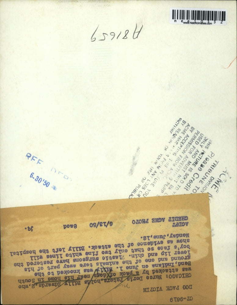 Load image into Gallery viewer, 1950 Press Photo Billy Edwards, after being attacked by a pack of dogs
