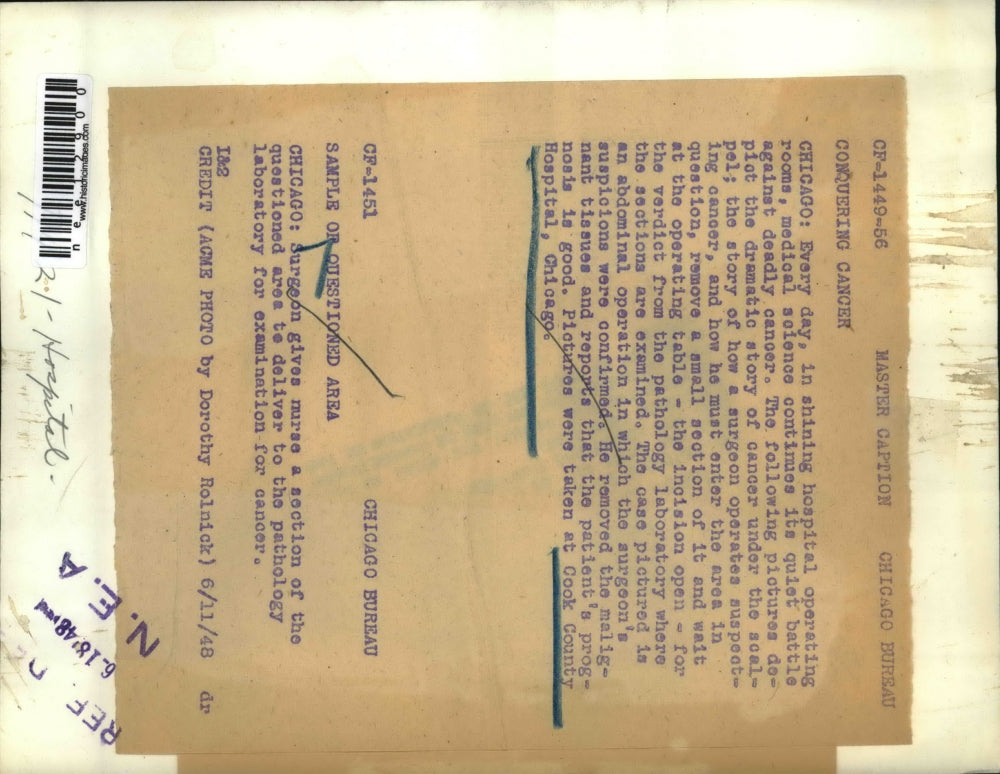 1948 Press Photo of a cancer surgery in Chicago. - nee12900