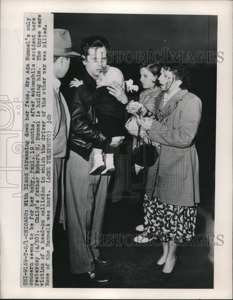 1950 Press Photo Injured Woman Ada Hummel, Family After Car Accident, Chicago