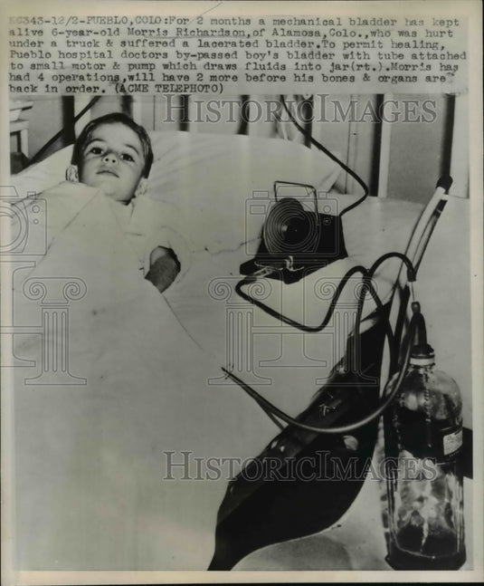 1947 Press Photo Morris Richardson Using Mechanical Bladder for 6 Months