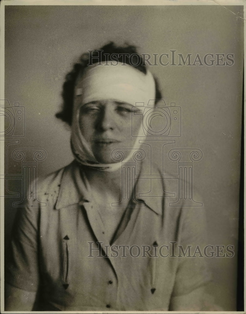 1936 Press Photo Mrs. Edna Morris Buttons on throat