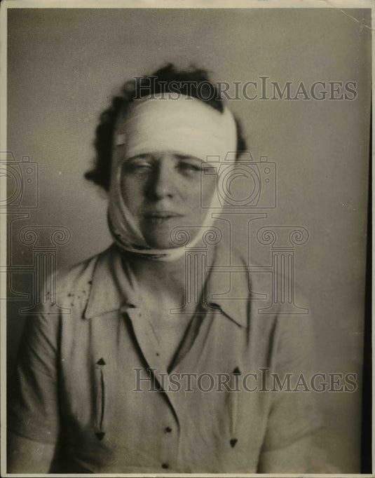 1936 Press Photo Mrs. Edna Morris Buttons on throat