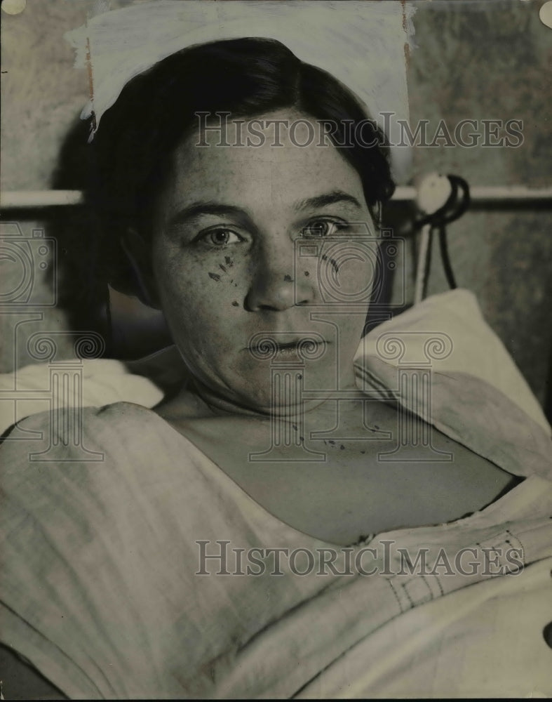 1933 Press Photo Mrs Gretchen McCullough in a bed after an injury - nee80377