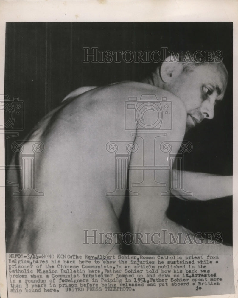 Load image into Gallery viewer, 1955 Press Photo Rev.Albert Sohier injuries white prisoners of Chinese Communist
