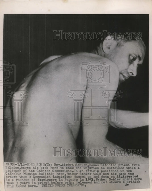 1955 Press Photo Rev.Albert Sohier injuries white prisoners of Chinese Communist