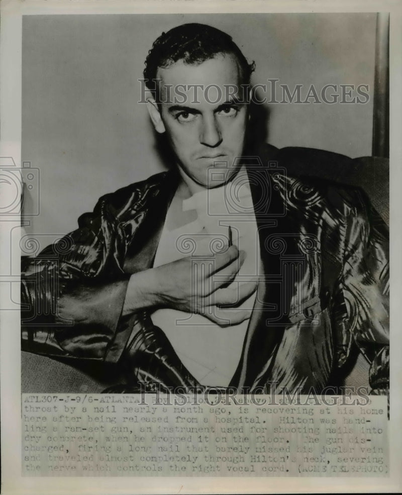 Load image into Gallery viewer, 1950 Press Photo Roy Hilton Recovering from Nail Gun Injury, Atlanta - nef15128

