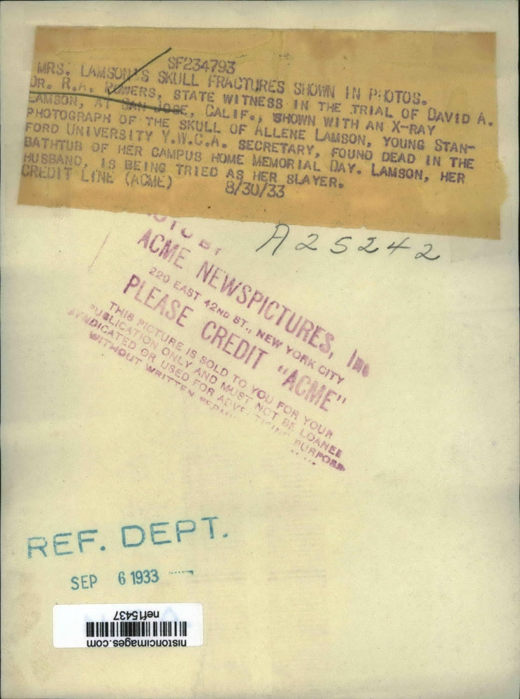 1933 Press Photo Dr. R. Rowers Shows Skull Fractures In Photos - nef15437