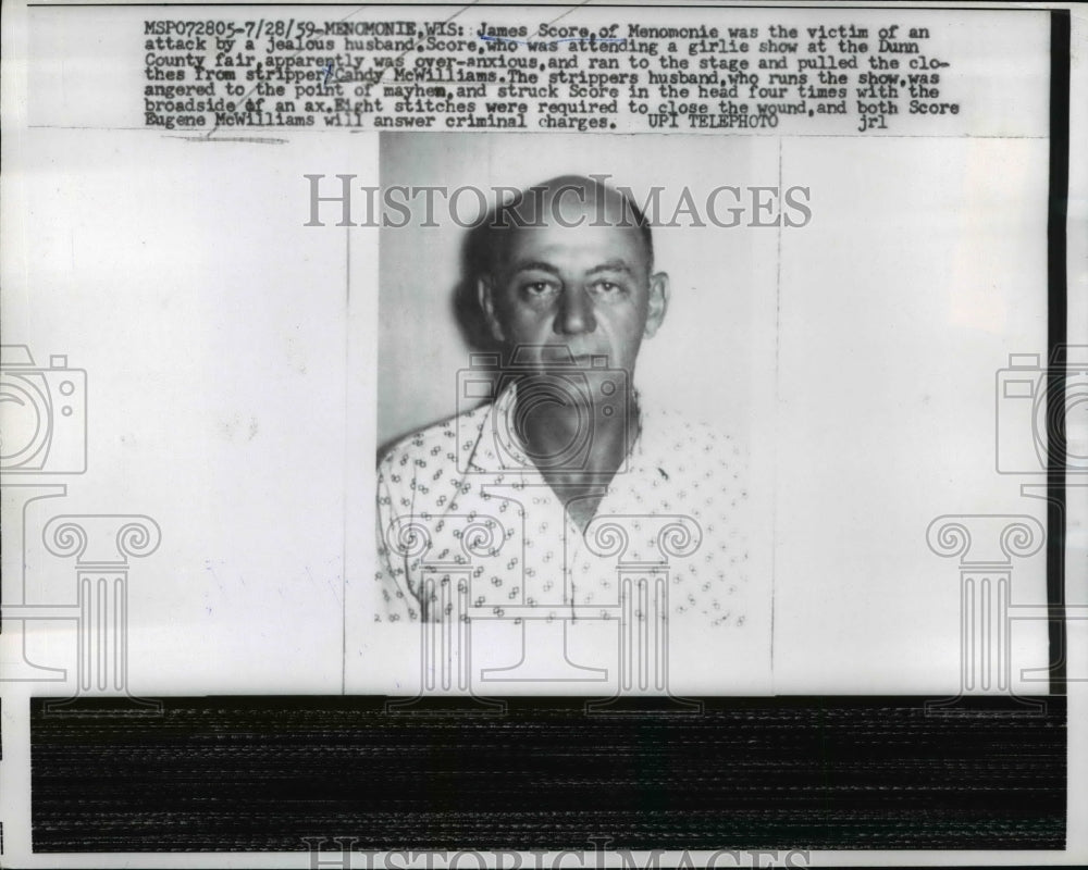 1959 Press James Score Victim of Attack By Jealous Husband Eugene McWilliams