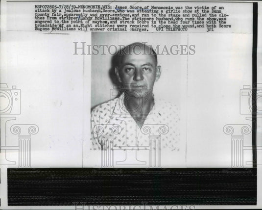 1959 Press James Score Victim of Attack By Jealous Husband Eugene McWilliams