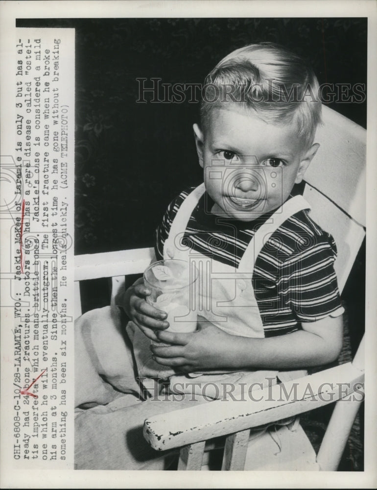 1949 Press Photo Three Year Old Jackie McKee Has Already Had 24 Bone Fractures