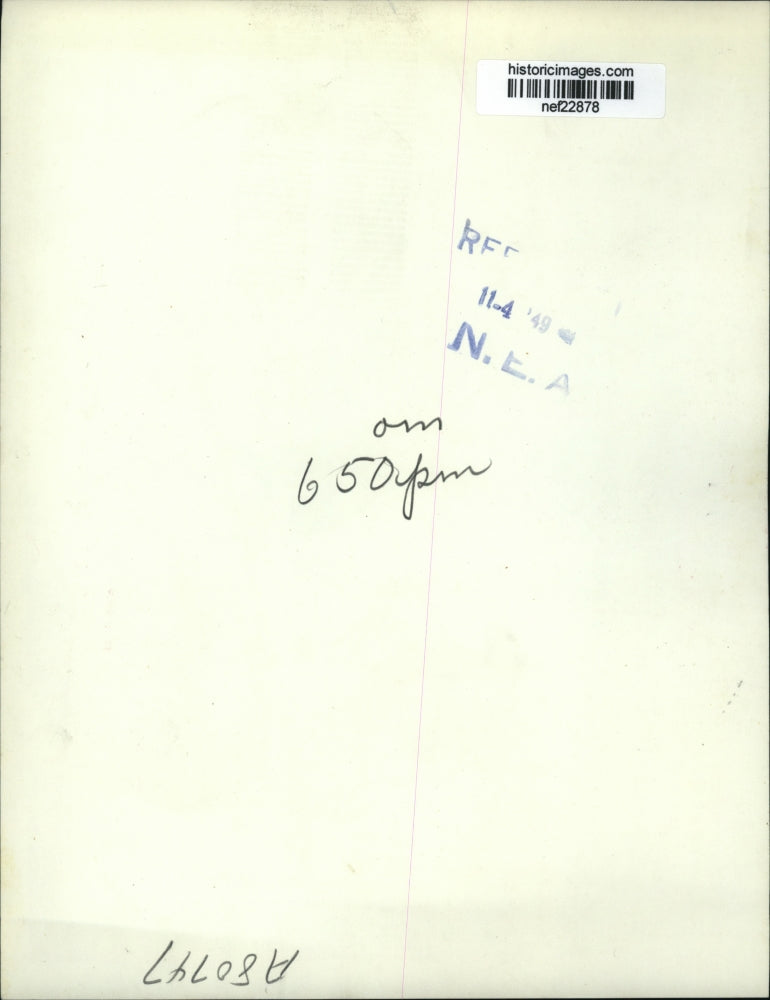 1949 Press Photo Three Year Old Jackie McKee Has Already Had 24 Bone Fractures