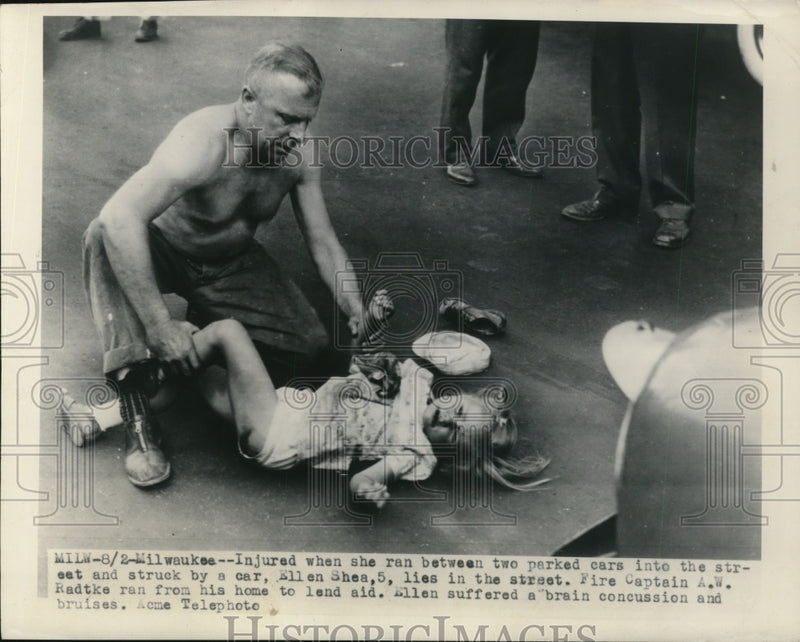 Load image into Gallery viewer, 1948 Press Photo Ellen Shea, 5, was hit by a car after she ran into the street
