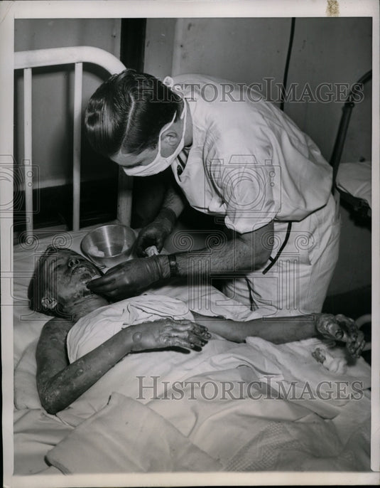 1949 Press Photo Roberta Lee Treated for Oil Fire Burns, Des Plaines, illinois