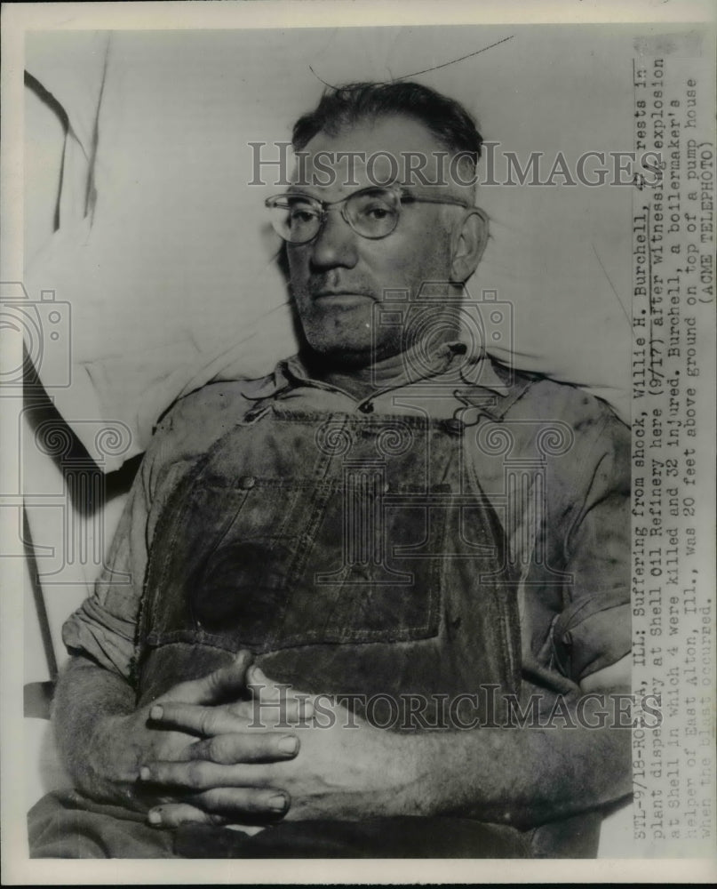 1951 Press Photo Willie H. Burchell after Shell Oil Refinery Explosion, Illinois
