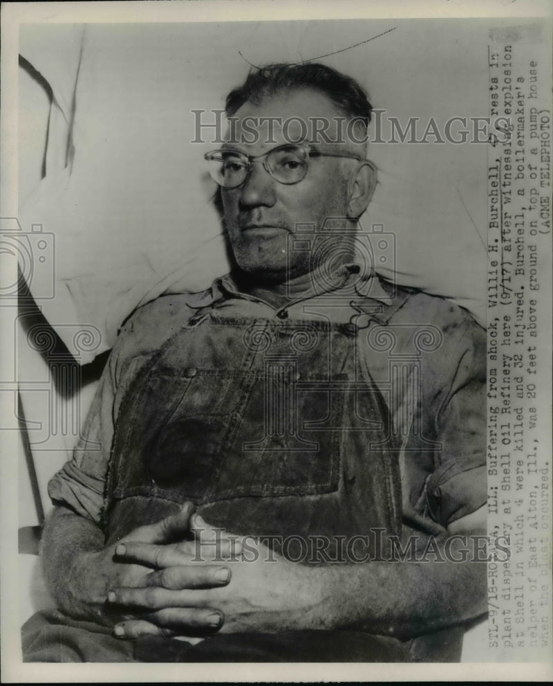 Load image into Gallery viewer, 1951 Press Photo Willie H. Burchell after Shell Oil Refinery Explosion, Illinois
