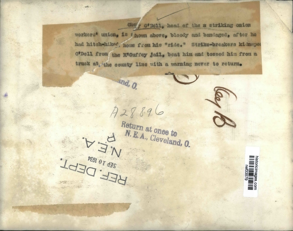 1934 Press Photo Okey O'Dell, Injured After Escaping Jail - nef33579