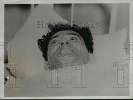 1937 Press Photo Louis Sherdy suffered in explosion aboard U.S Destroyer Cassin