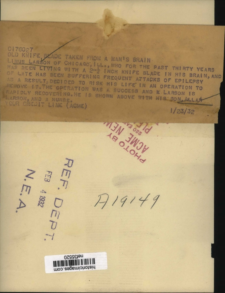 1932 Press Photo Linus Larson of Chicago in Hospital for Blade in Brain Removal