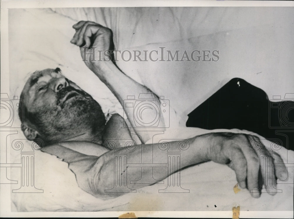 1939 Press Photo John Kasper of Hebron in Missouri Hospital for Sunstroke