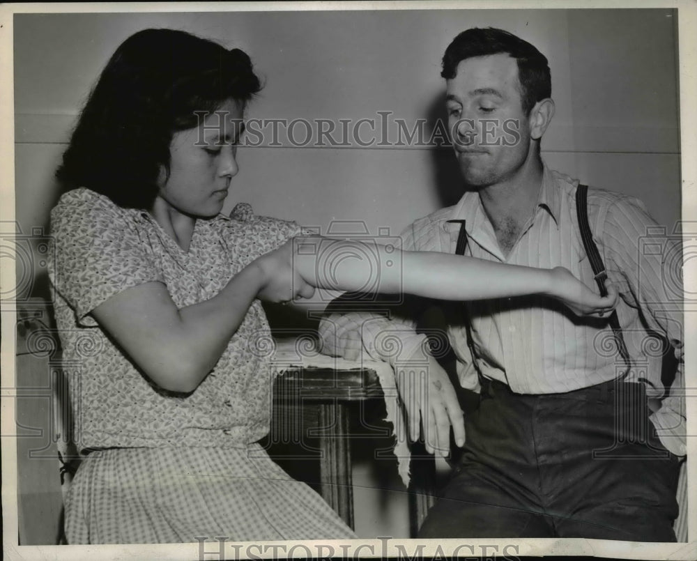 1944 Press Photo Terry shows bruise she claims was inflicted by irate neighbor