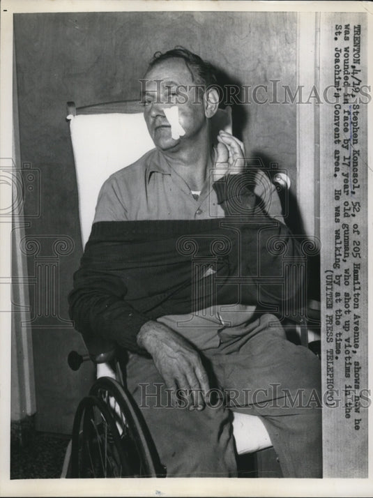1958 Press Photo Stephen Koncsol Shows Wounded in Face by 17-Year-Old Gunman