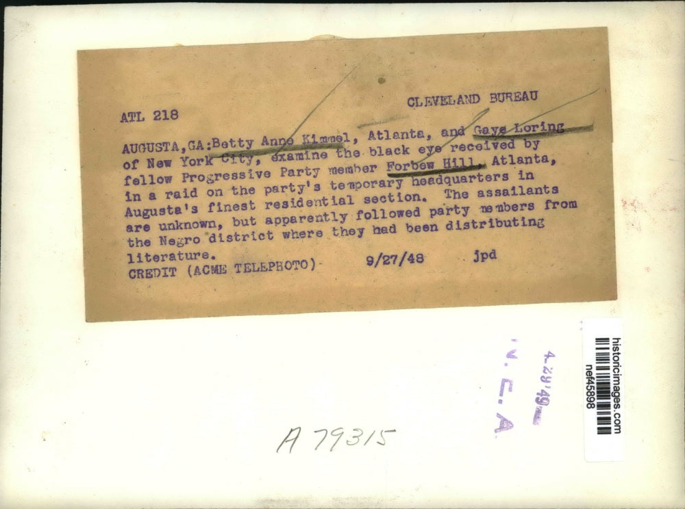 1948 Press Photo Progressive Party Member Forbew Hill w Black Eye, Augusta, GA