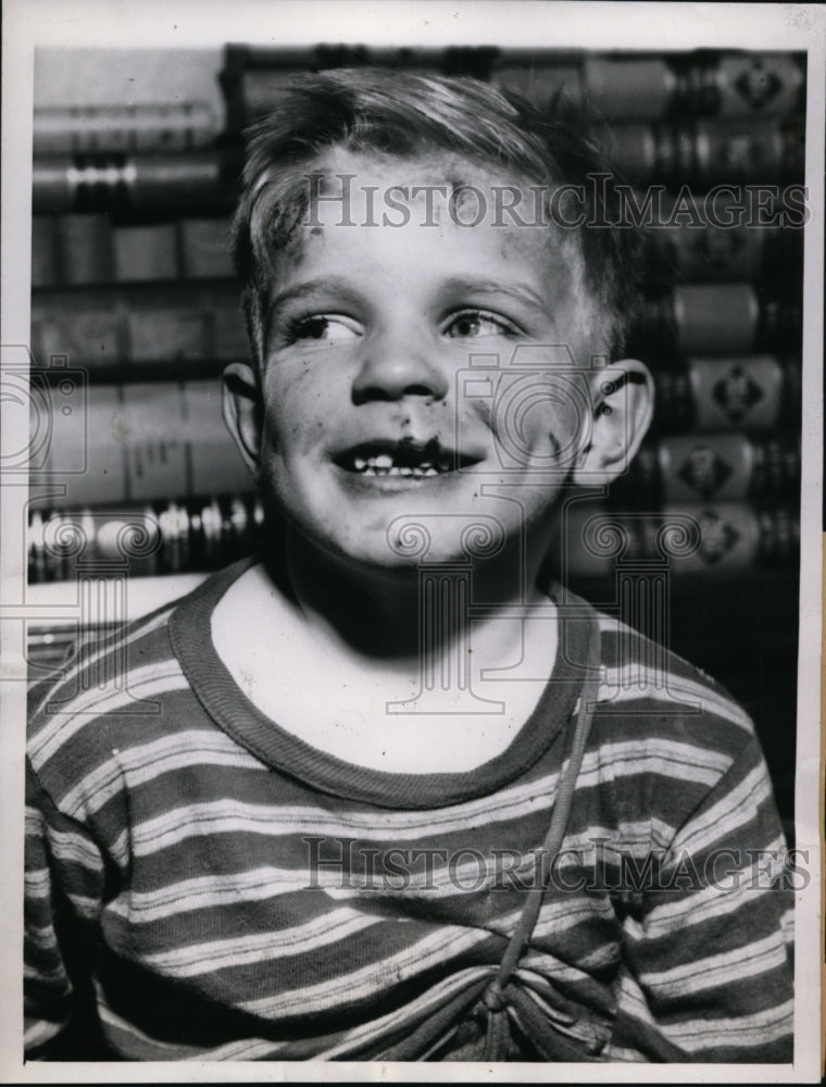 1943 Press Photo Five Year Old Arthur Haselton Beat & Kicked in Mouth by Father