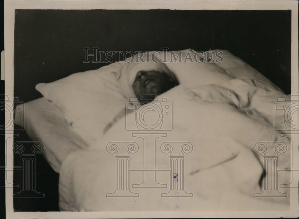 1921 Press Photo Captain Mann of R-38 Wreck in Hospital - nef47280