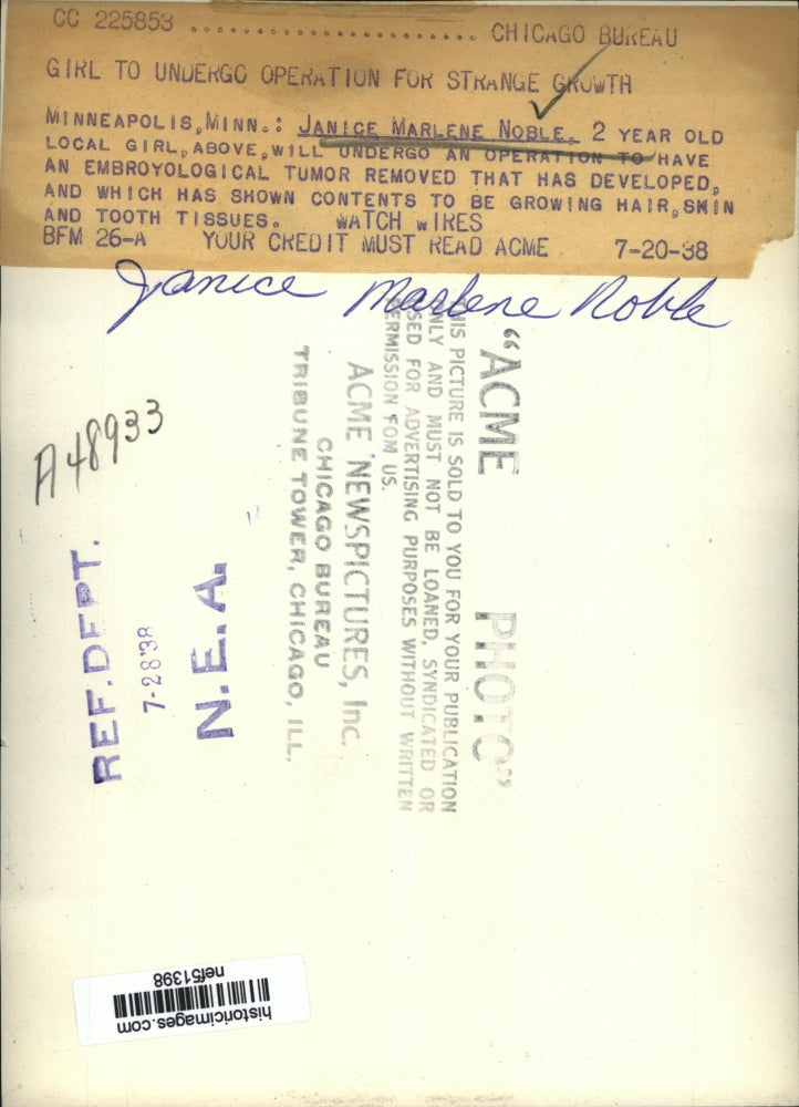 1938 Press Photo Janice Marlene Noble Undergo A Tumor Operation - nef51398