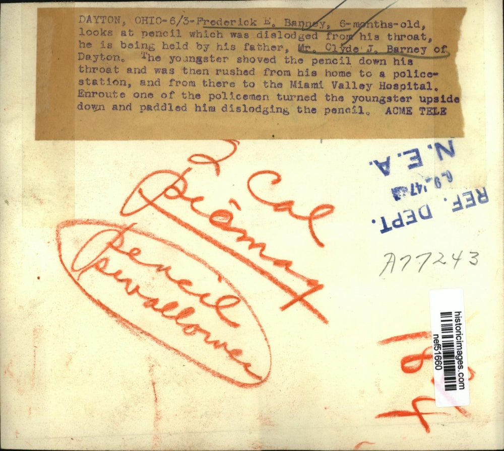 1947 Press Photo Baby Frederick Banney after Pencil Dislodged from Throat