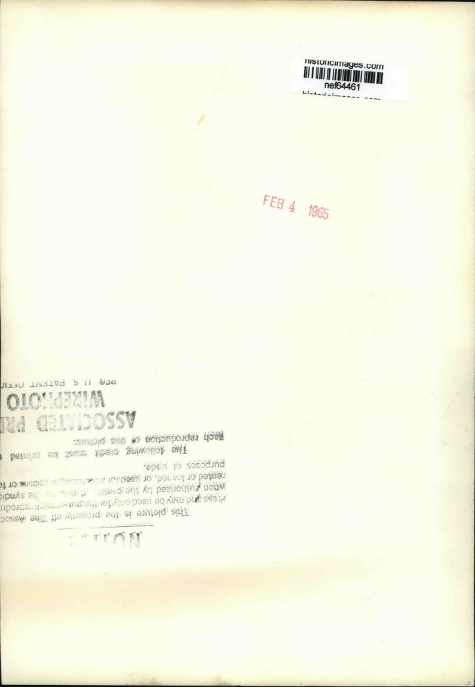 1935 Press Photo George Chvalo Canadian Boxer shows his damage Eyes - nef64459