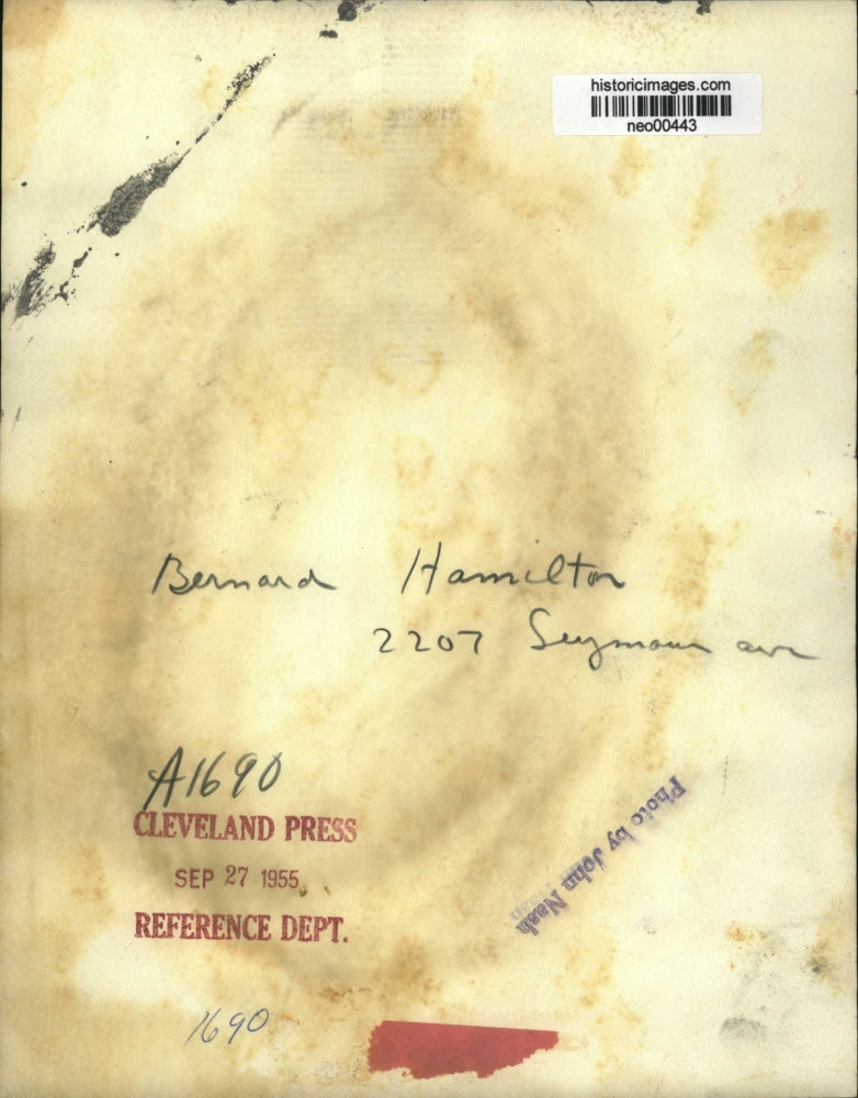 1955 Press Photo Bernard Hamilton with Bruised eye - neo00443